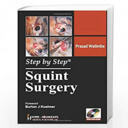 STEP BY STEP SQUINT SURGERY by WALIMBE Book-9789350251966