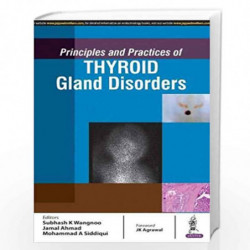 Principles And Practices Of Thyroid Gland Disorders by WANGNOO SUBHASH K Book-9789386056252