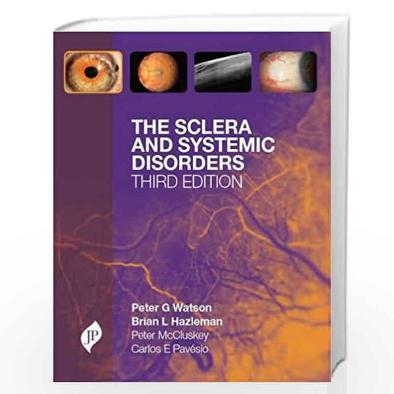 The Sclera And Systemic Disorders by WATSON Book-9781907816079