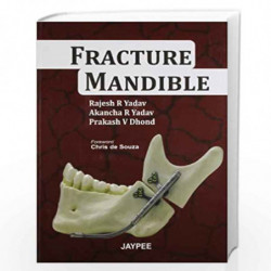 Fracture Mandible by YADAV Book-9789350258019