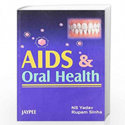 Aids & Oral Health by YADAV Book-9788180618239