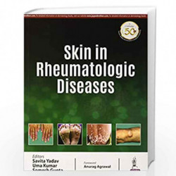 Skin in Rheumatologic Diseases by YADAV SAVITA Book-9789352705054