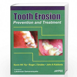 Tooth Erosion Prevention And Treatment by YIP Book-9788180617515