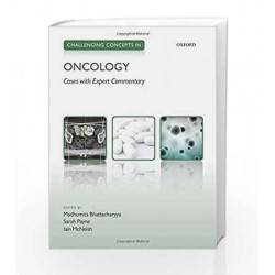 Challenging Concepts in Oncology by 0 Book-9780199688883