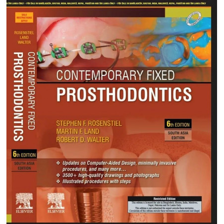 Contemporary Fixed Prosthodontics, 6e, South Asia Edition book by Rosenstiel