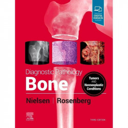 Diagnostic Pathology: Bone, 3e book by G. Petur Nielsen MD, Andrew E Rosenberg MD
