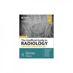 The Unofficial Guide to Radiology: 100 Practice Abdominal X-rays, 2/e book by Zeshan Qureshi
