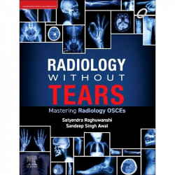 Radiology Without Tears: Mastering Radiology Osces book by Satyendra Raghuwanshi, Sandeep Singh Awal