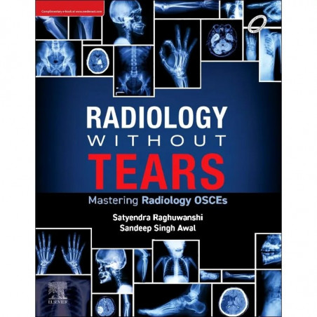 Radiology Without Tears: Mastering Radiology Osces book by Satyendra Raghuwanshi, Sandeep Singh Awal