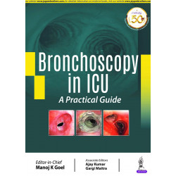 Bronchoscopy in ICU book by Dr Manoj K Goel / Dr Ajay Kumar / Dr Gargi Maitra, This book provides a state of art detailed de…