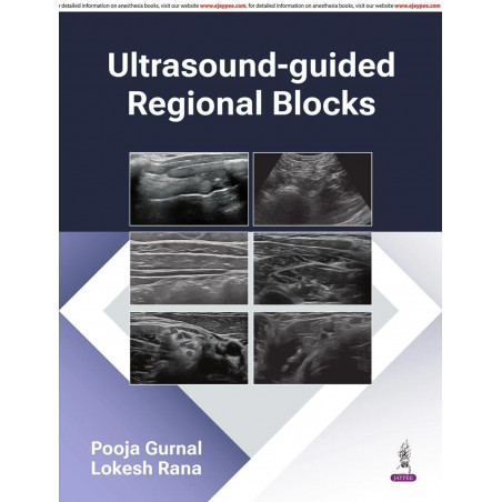 Ultrasound-Guided Regional Blocks book by Pooja Gurnal, Lokesh Rana