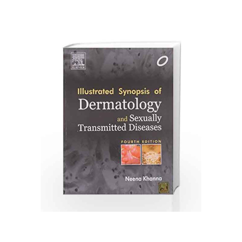 Illustrated Synopsis of Dermatology and Sexually Transmitted Diseases (Old Edition) by Dr. Neena Khanna Book-9788131228029