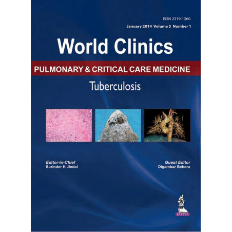 WORLD CLINICS PULMONARY & CRITICAL CARE MEDICINE:TUBERCULOSIS (JAN.2014, VOL.3,NO.1) book by Jindal Surinder K