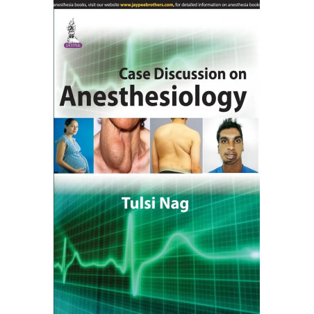 Case Discussion On Anesthesiology book by M.D. Nag, Tulsi
