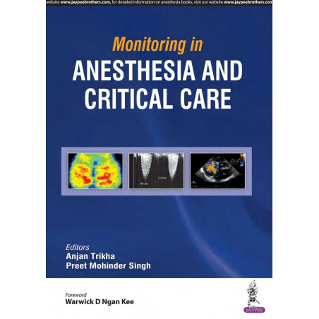 MONITORING IN ANESTHESIA AND CRITICAL CARE book by Anjan Trikha, Preet Mohinder Singh