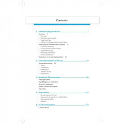 AIRWAY MANAGEMENT book by Geetanjali S Verma - Additional Image 6