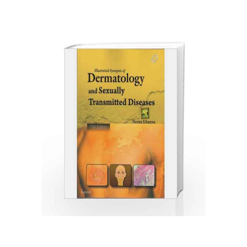 Illustrated Synopsis of Dermatology and Sexually Transmitted Diseases by Neena Khanna Book-9788131242308
