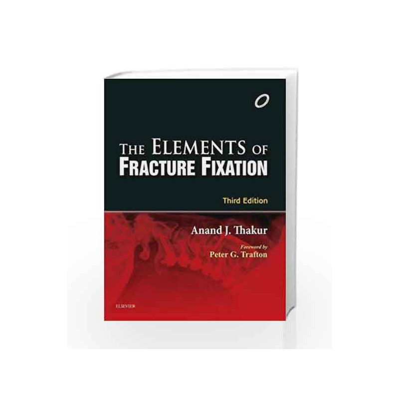 The Elements of Fracture Fixation by Thakur Book-9788131242360