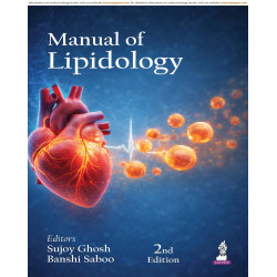 Manual of Lipidology, 2/E for Endocrinologists, Cardiologists and Diabetologists | Evidence-Based Guide to Statins, PCSK9 In…
