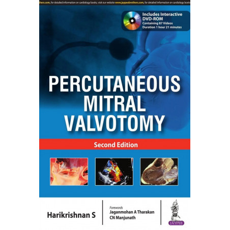 Percutaneous Mitral Valvotomy with Interactive DVD-ROM book by Harikrishnan S
