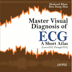 Master Visual Diagnosis of ECG: A Short Atlas book by Shahzad Khan