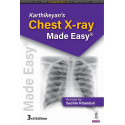 KARTHIKEYAN'S CHEST X-RAY MADE EASY book by Sachin Khanduri
