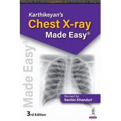 KARTHIKEYAN'S CHEST X-RAY MADE EASY book by Sachin Khanduri