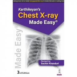 KARTHIKEYAN'S CHEST X-RAY MADE EASY book by Sachin Khanduri - Back Cover