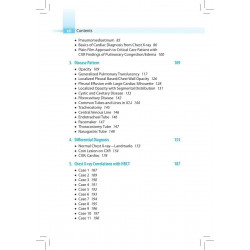 KARTHIKEYAN'S CHEST X-RAY MADE EASY book by Sachin Khanduri - Additional Image 7