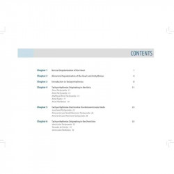 Arrhythmias 101 (The Ultimate Easy-to-read Introductory Book) book by Levine - Additional Image 4