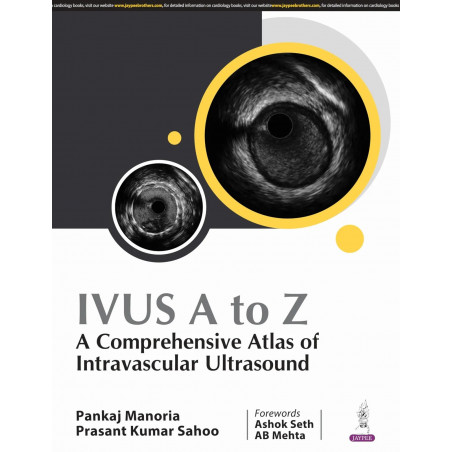 IVUS A TO Z : A COMPREHENSIVE ATLAS OF INTRAVASCULAR ULTRASOUND book by Pankaj Manoria, Prasant Kumar Sahoo