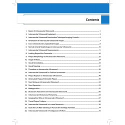 IVUS A TO Z : A COMPREHENSIVE ATLAS OF INTRAVASCULAR ULTRASOUND book by Pankaj Manoria, Prasant Kumar Sahoo - Additional Image 5
