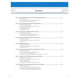 DECODING CTO (CHRONIC TOTAL OCCLUSION) CASE-BASED DISCUSSIONS book by Sharath Reddy, Himanshu Gupta - Additional Image 6