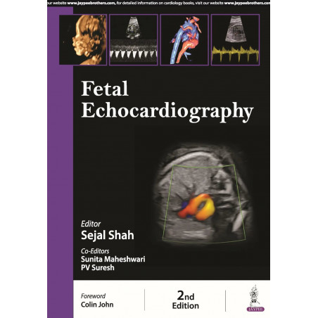 FETAL ECHOCARDIOGRAPHY book by Sejal Shah, PV Suresh Sunita Maheshwari