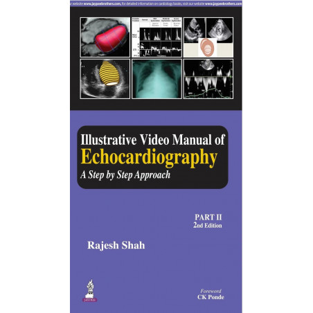 Illustrative Video Manual of Echocardiography: A Step by Step Approach (Part II) (POD) book by Rajesh Shah