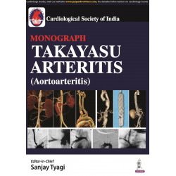 CSI Monograph Takayasu Arteritis (Aortoarteritis) book by Sanjay Tyagi, George Joseph Debabrata Roy