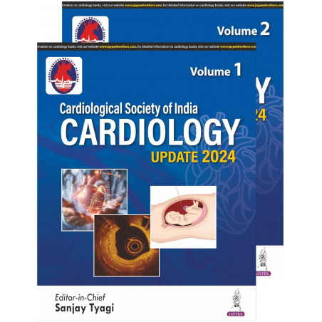 CSI CARDIOLOGY UPDATE 2024 (2 VOLS): Two Volume Set book by Sanjay Tyagi, Mohit D Gupta
