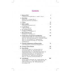 ECG for Beginners book by Subramanian Anandaraja - Additional Image 5