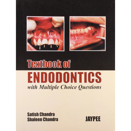 Textbook of Endodontics with M.C.Qs book by Chandra