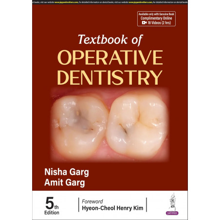 Textbook of Operative Dentistry, 5/E for BDS Students and Dental Practitioners | 35 Chapters, DCI Syllabus-Aligned with 18 F…