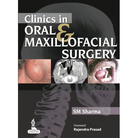 CLINICS IN ORAL & MAXILLOFACIAL SURGERY book by Sharma