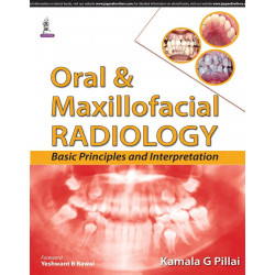 ORAL & MAXILLOFACIAL RADIOLOGY BASIC PRINCIPLES AND INTERPRETATION book by Pillai Kamala G