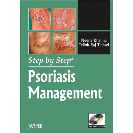STEP BY STEP PSORIASIS MANAGEMENT WITH PHOTO CD-ROM book by Khanna