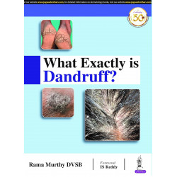 WHAT EXACTLY IS DANDRUFF book by Rama Murthy
