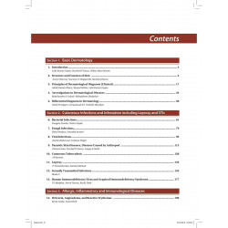 Jaypee Brothers Medical Publishers Iadvl'S Concise Textbook Of Dermotology book by Lalit Kumar Gupta - Additional Image 5