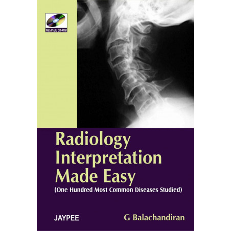 RADIOLOGY INTERPRETATION MADE EASY book by Balachandiran
