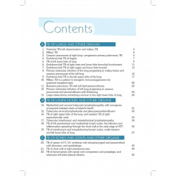DIFFICULT DIAGNOSIS & MANAGEMENT OF TUBERCULOSIS MADE EASY book by Tosaddak Ahmed - Additional Image 5