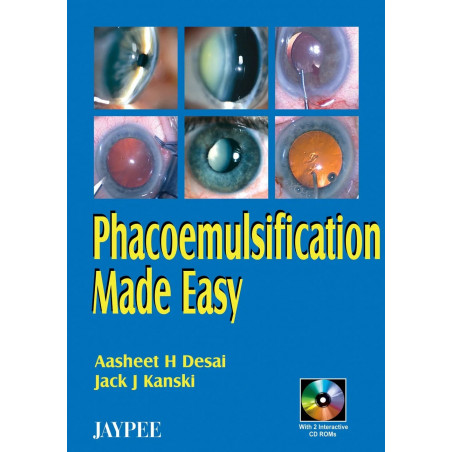 Phacoemulsification Made Easy With 2 Int.Cd Roms book by Desai
