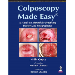 Coloposcopy Made Easy with Photo CD-ROM book by Gupta Nidhi