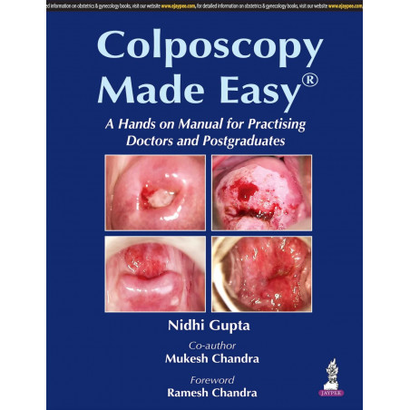 Coloposcopy Made Easy with Photo CD-ROM book by Gupta Nidhi